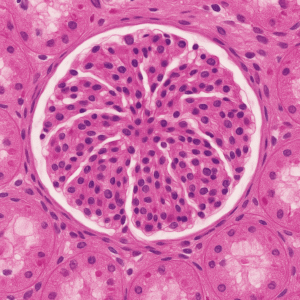 A glomerular tuft surrounded by renal tubules as seen on kidney biopsy specimens.