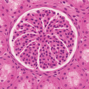 A glomerular tuft surrounded by renal tubules as seen on kidney biopsy specimens.