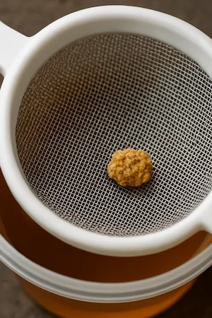Kidney stone collected in a strainer, resulting from metabolic stone disease